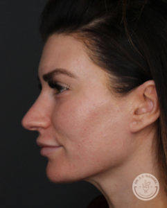 left side profile of woman with brunette hair
